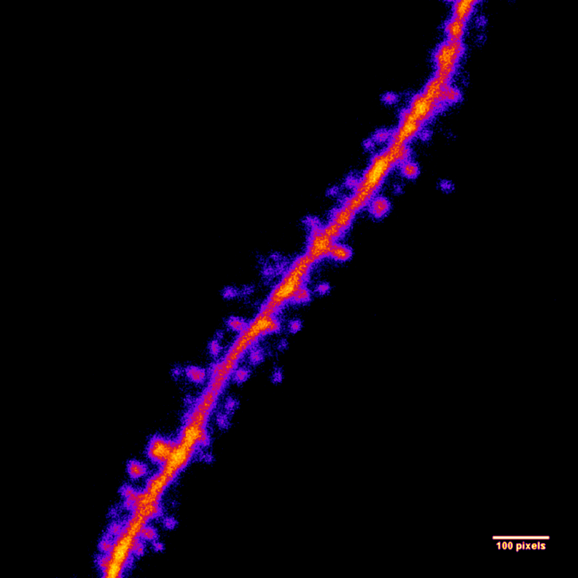 neuronal dendrite with dendritic spines